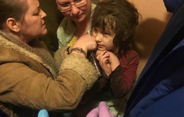 В Москве нашли девочку-маугли с вросшим в шею проводом в груде мусора. В Москве сотрудники МЧС вскрыли квартиру и нашли в грудах мусора плачущего пятилетнего ребенка. Её внешний вид ошеломил